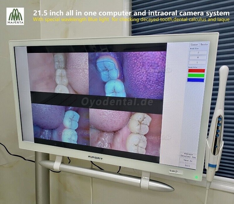 Magenta YF-2200P+21,5-Zoll-LCD-Monitor Touchscreen Intraoralkamera VGA + HDMI
