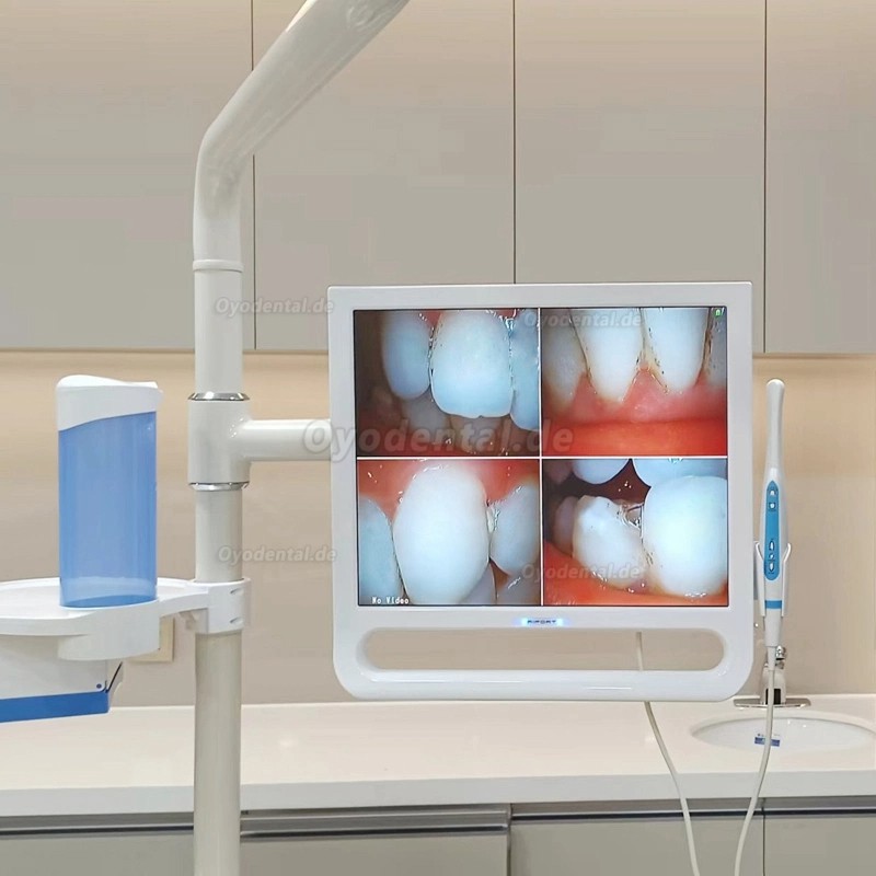 YF1700M 17-Zoll Dental Intraoralkamera mit Monitor und Halterung 1024 x 768 Pixel
