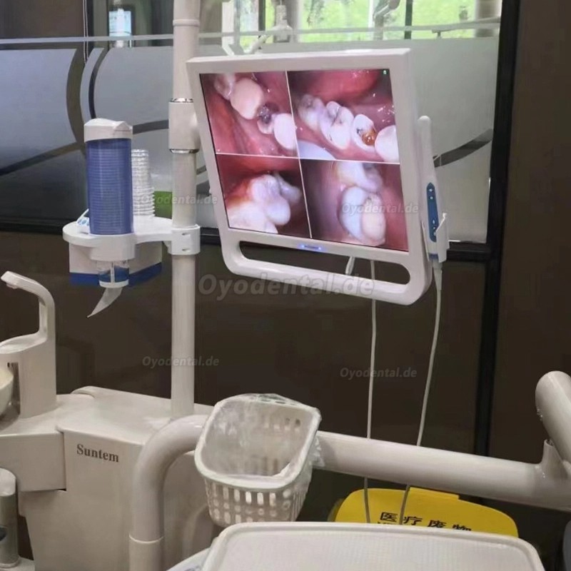 YF1700M 17-Zoll Dental Intraoralkamera mit Monitor und Halterung 1024 x 768 Pixel