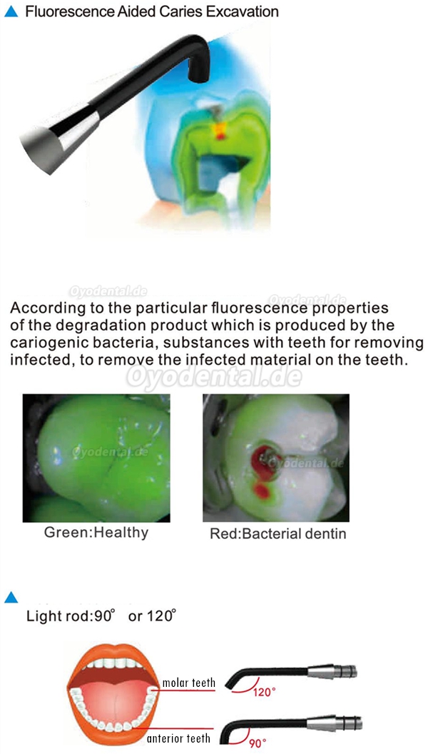 Endodontie& Wurzelbehandlung Zahnkariesdetektor C-Hunter