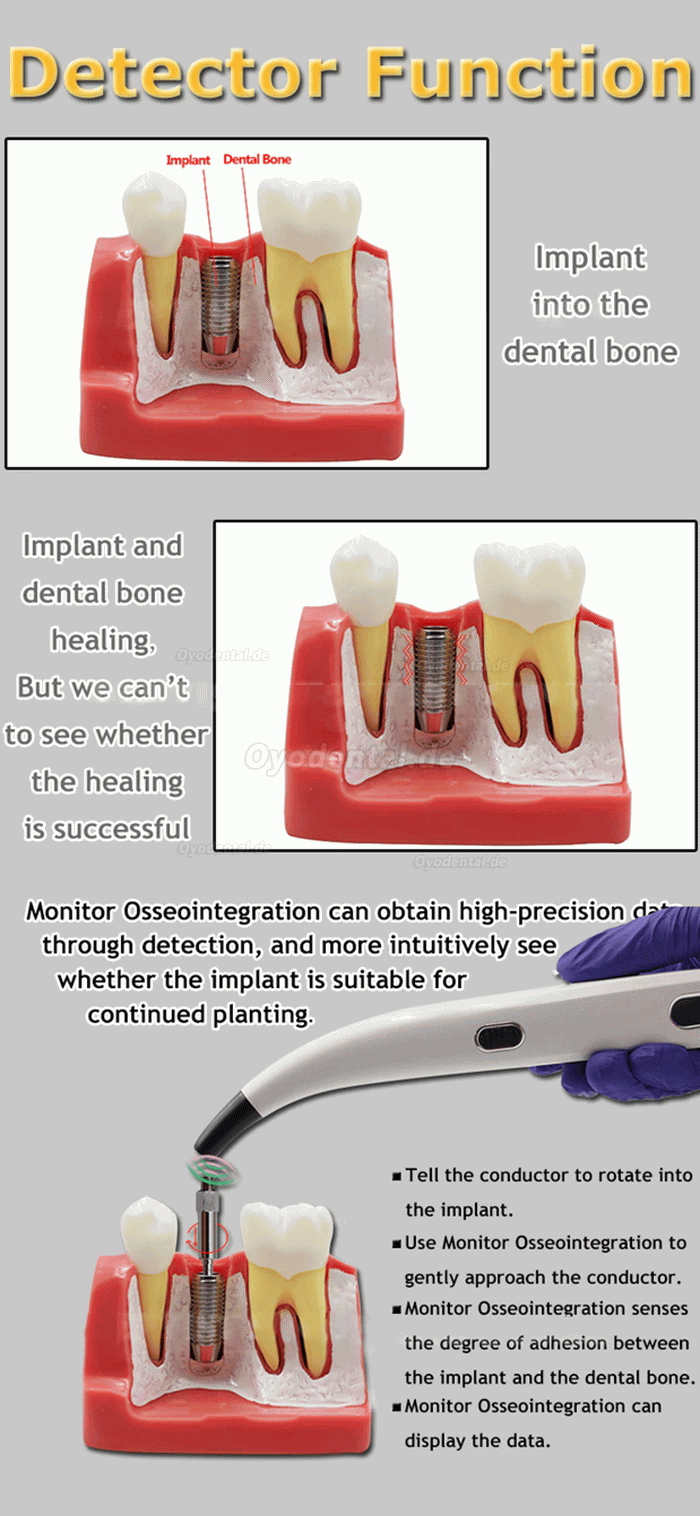 Tragbares Dental ISQ Implantatstabilitätsmonitor-Testgerät, Implantatstabilitätsmessgerät