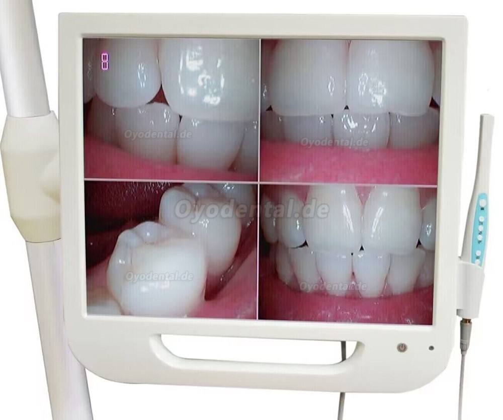 17-Zoll-High-Definition-Digital-LCD-AIO-Monitor Dental Intraorale Kamera